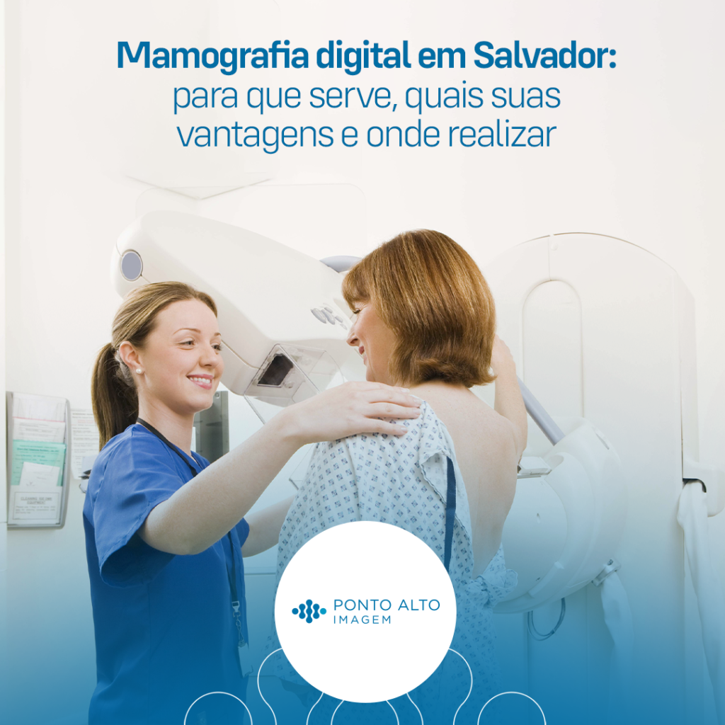 Mamografia em Salvador