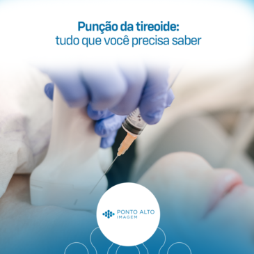 Punção da Tireoide